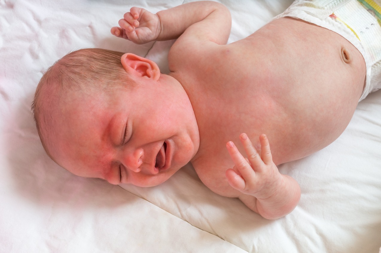 Is it true that premature babies are more prone to have baby colic?